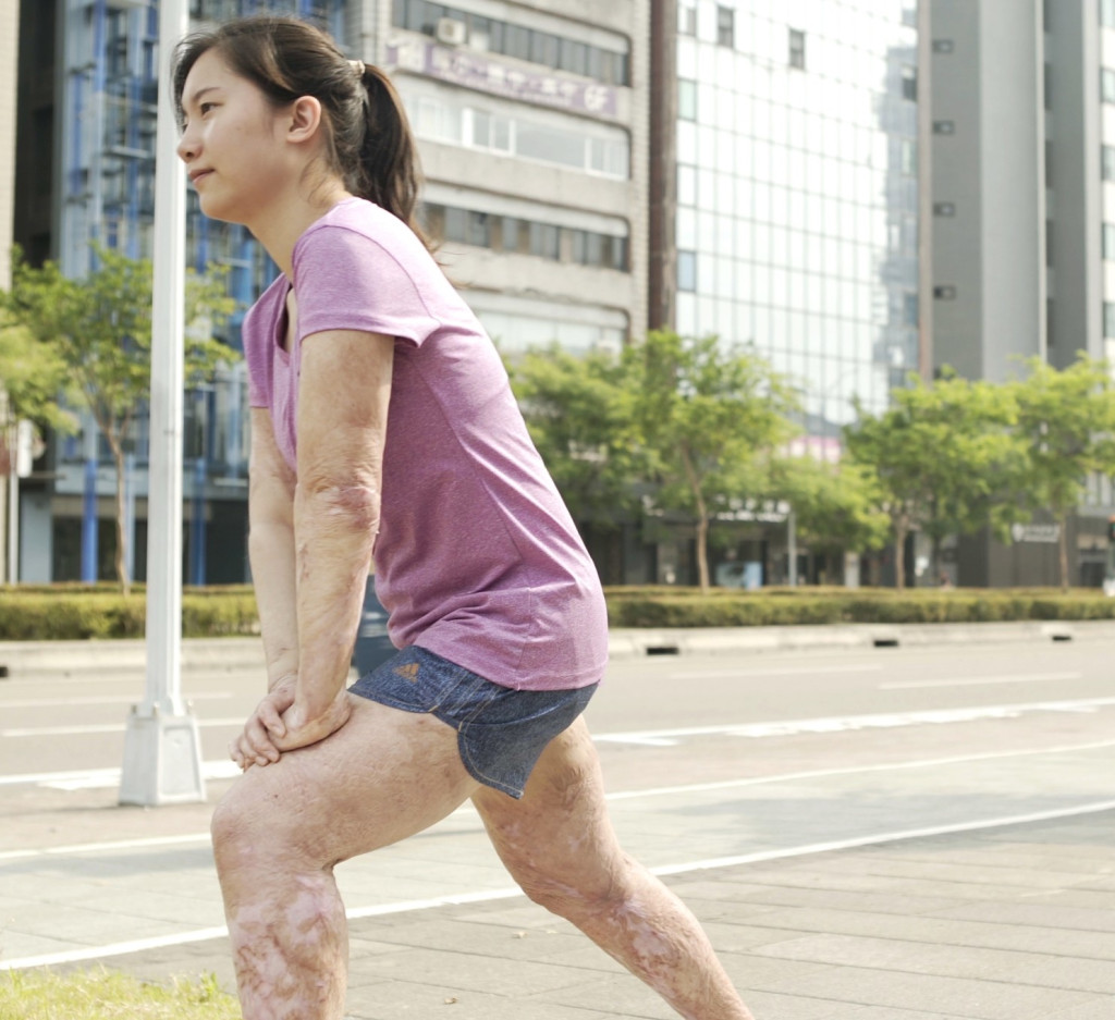 可渝歷經3000多小時重建，重拾熱愛的運動，去年7月還完成人生第一個半馬。圖／陽光基金會提供