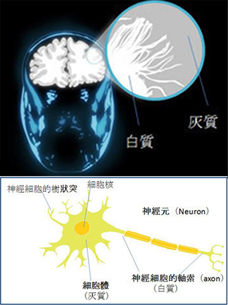 灰質是處理訊息的地方，而白質是連絡大腦不同部位的線路，讓概念能集結一起。增加的白質讓病態說謊者有更多的「線路和工具」助他們掌握「欺騙的藝術」