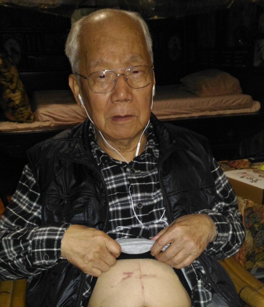 林水泉展示切腹時留下的橫切不規則刀疤。圖／陳婉真
