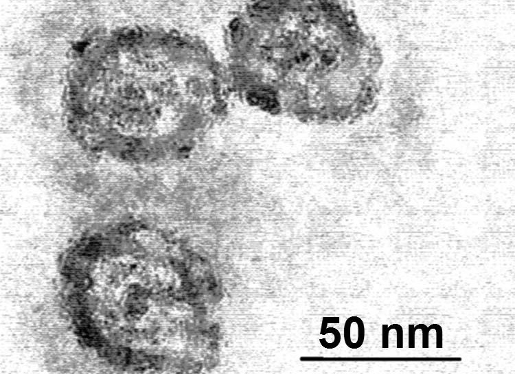 C型肝炎（Hepatitis C）。圖／取自維基百科（Photo: PhD Dre/ CC by 3.0）