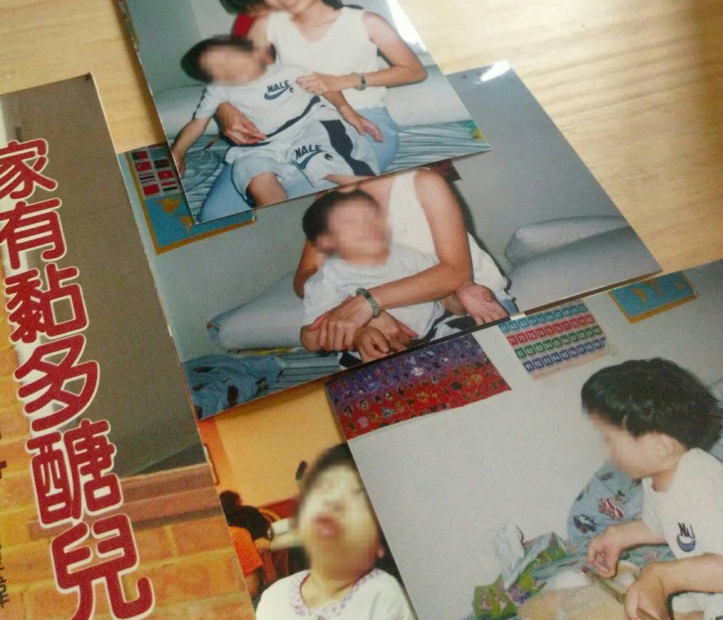 10多年前，黏多醣症並無有效的治療方法，但目前第一型、第二型輕型、第六型及第四A型患者的酵素替代療法已核准上市。圖／楊惠君攝